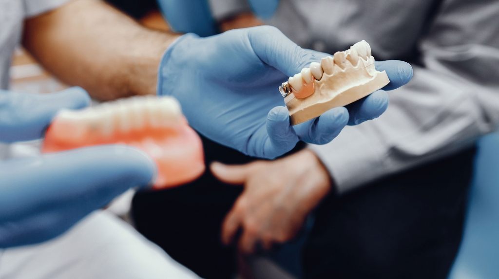 protesis-dental-algeciras-uniclinic