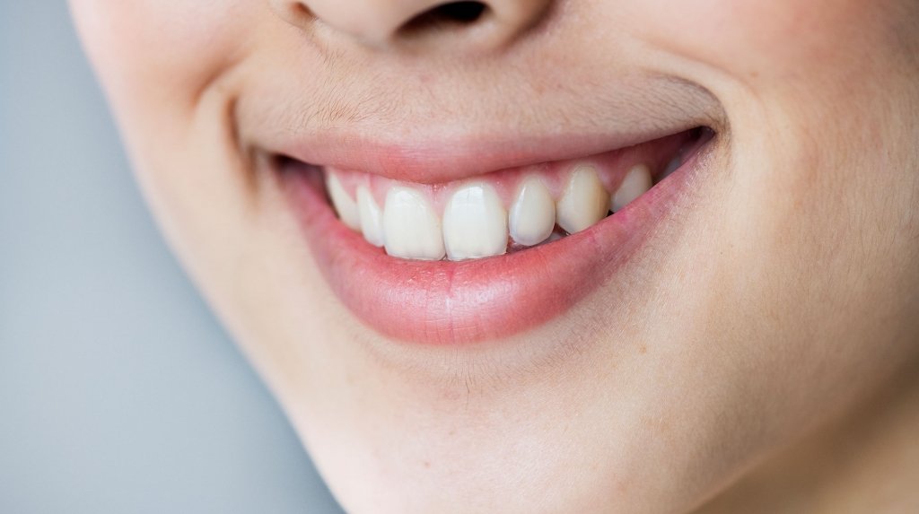 fundas-dentales-la-linea-uniclinic