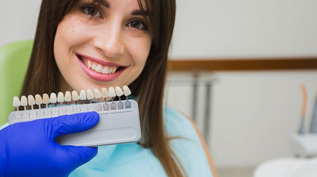 carillas-dentales-uniclinic-la-linea
