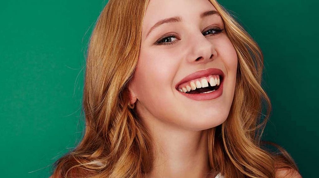 diastema-solucion-algeciras-uniclinic